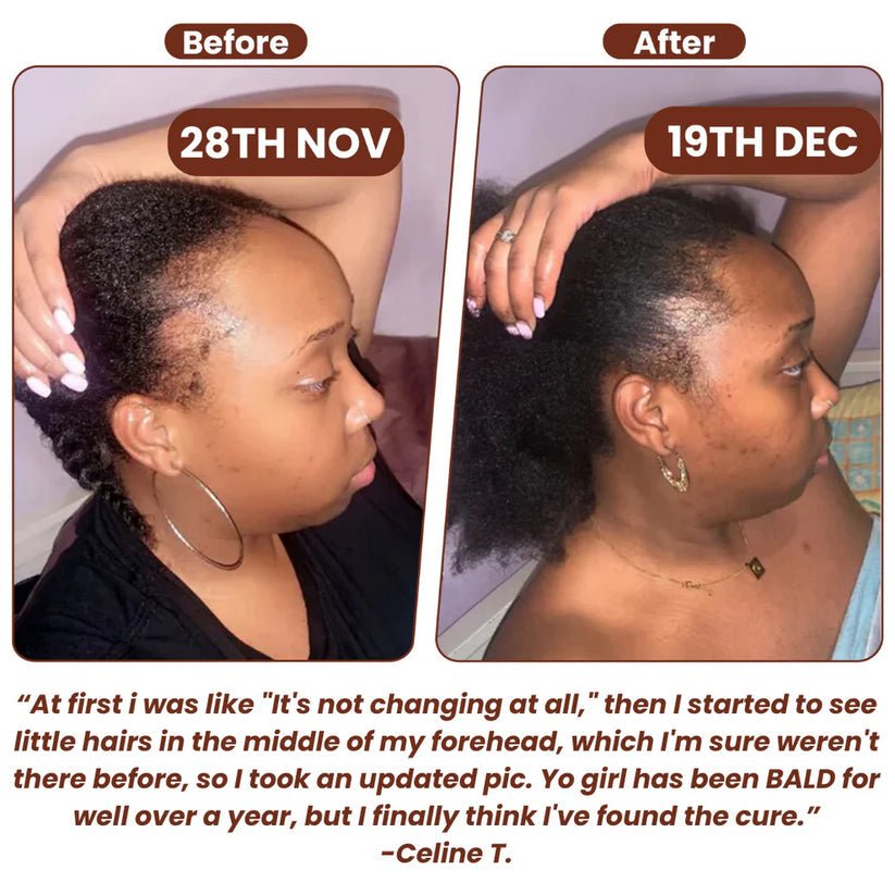 100% Unrefined Batana Oil - ORENDA