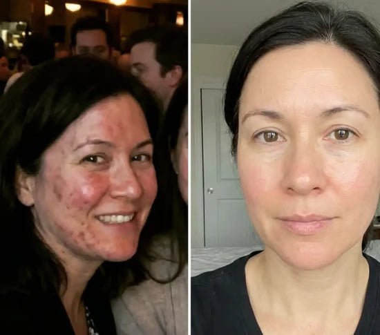 ORENDA Astaxanthin - ORENDA