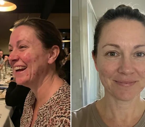 ORENDA Astaxanthin - ORENDA